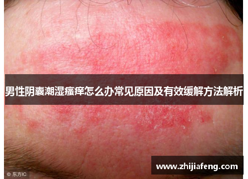 男性阴囊潮湿瘙痒怎么办常见原因及有效缓解方法解析