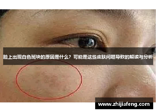 脸上出现白色斑块的原因是什么？可能是这些皮肤问题导致的解读与分析